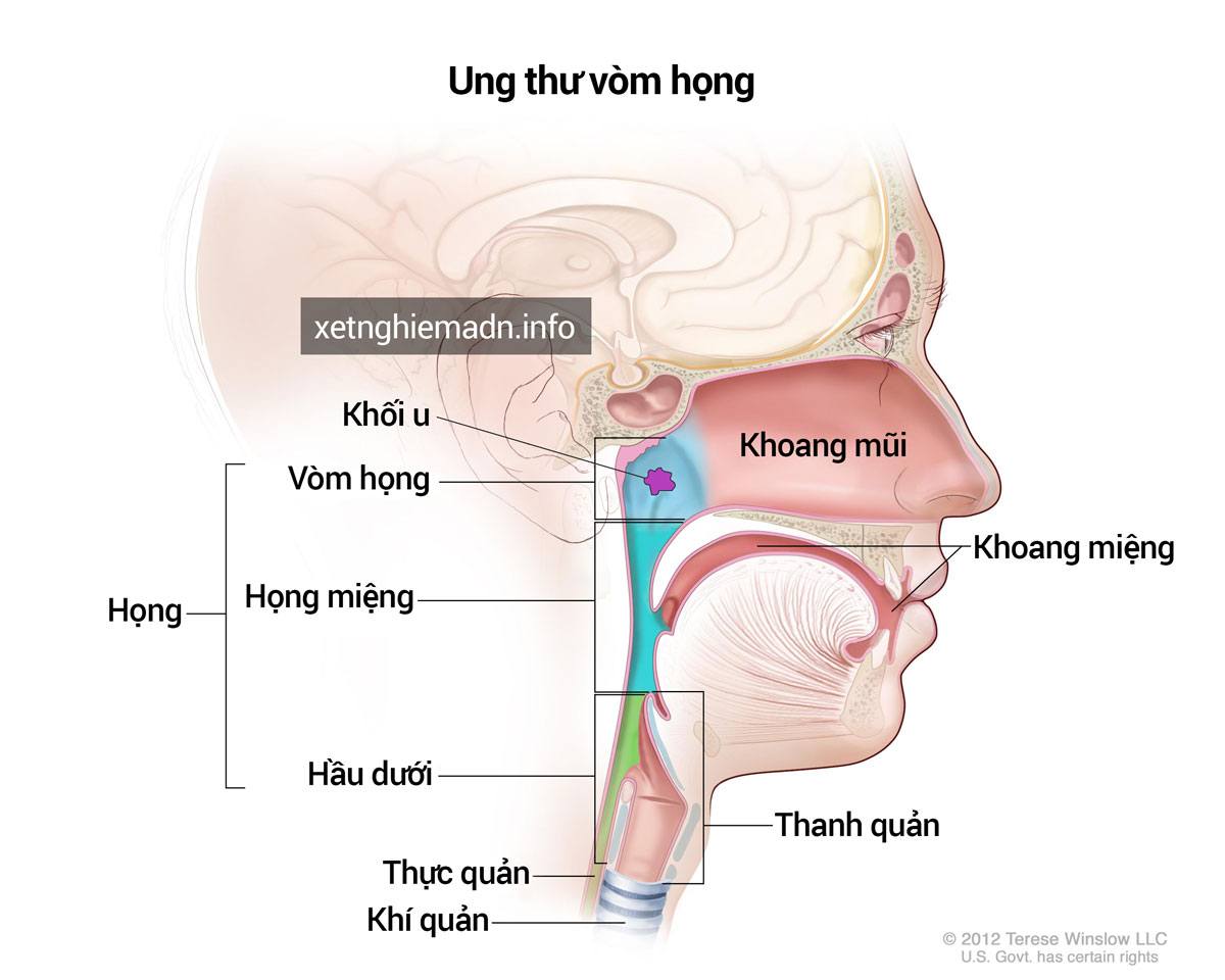 Ung thư vòm họng 4 dấu hiệu cảnh báo sớm và những điều cần lưu ý